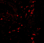 LAMP-1 Antibody