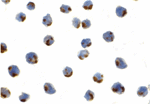 IRE1p Antibody