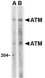 ATM Antibody