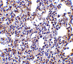 PKR Antibody