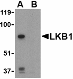 LKB1 Antibody