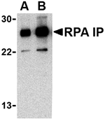 RPA Interacting Protein Antibody