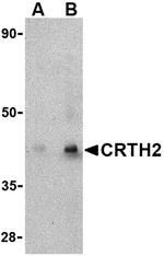 CRTH2 Antibody