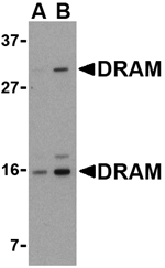 DRAM Antibody