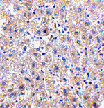 DRAM Antibody