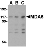 MDA5 Antibody SAB Signalway Antibody