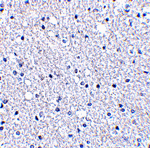 TIGAR Antibody