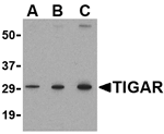 TIGAR Antibody