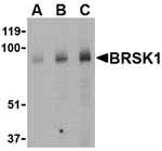 BRSK1 Antibody
