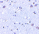BRSK1 Antibody