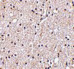 BRSK2 Antibody