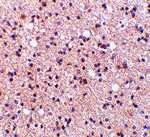 NPAS3 Antibody