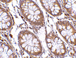 PTK7 Antibody