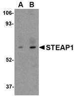 STEAP1 Antibody