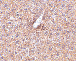 STEAP3 Antibody