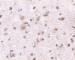 BRCC45 Antibody