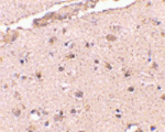 BRCC36 Antibody