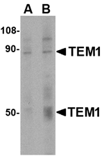 TEM1 Antibody