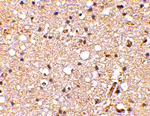 Grik1 Antibody