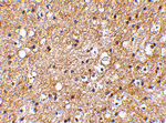 IPR1 Antibody