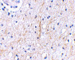 Plxdc2 Antibody