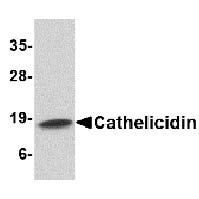 Cathelicidin Antibody