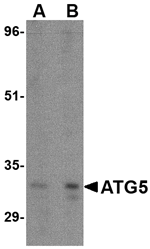 ATG5 Antibody