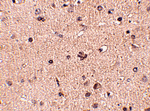 Slitrk2 Antibody