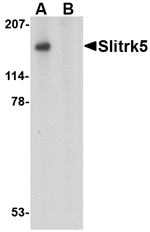 Slitrk5 Antibody