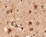 Slitrk5 Antibody