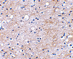 LGI1 Antibody