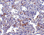 EVER1 Antibody