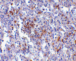 EVER1 Antibody