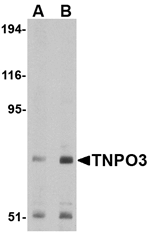 TNPO3 Antibody