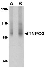 TNPO3 Antibody