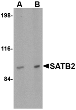 SATB2 Antibody