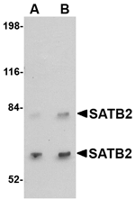 SATB2 Antibody