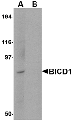 BICD1 Antibody