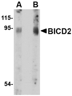 BICD2 Antibody