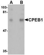 CPEB1 Antibody