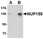 NUP155 Antibody