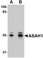 ASAH1 Antibody