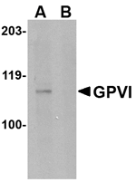 GPVI Antibody