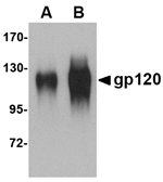 gp120 Antibody