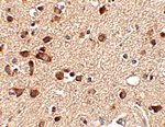 Stk39 Antibody