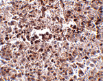 MettL7B Antibody