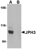 JPH3 Antibody