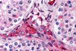 PTCHD2 Antibody