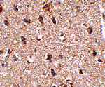 JPH3 Antibody