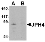 JPH4 Antibody